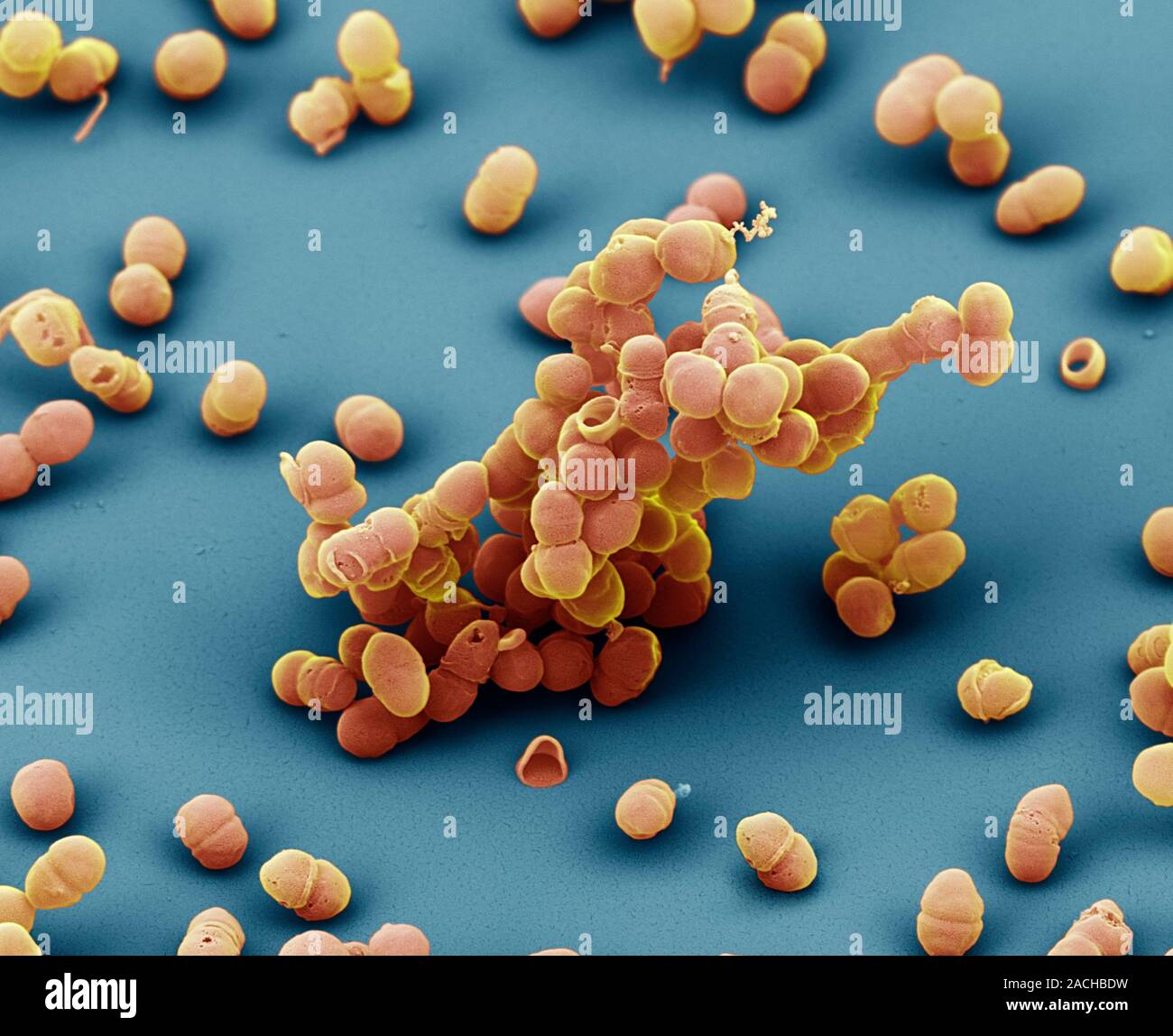 Staphylococcus Epidermidis Color Análisis Micrografía De Electrones