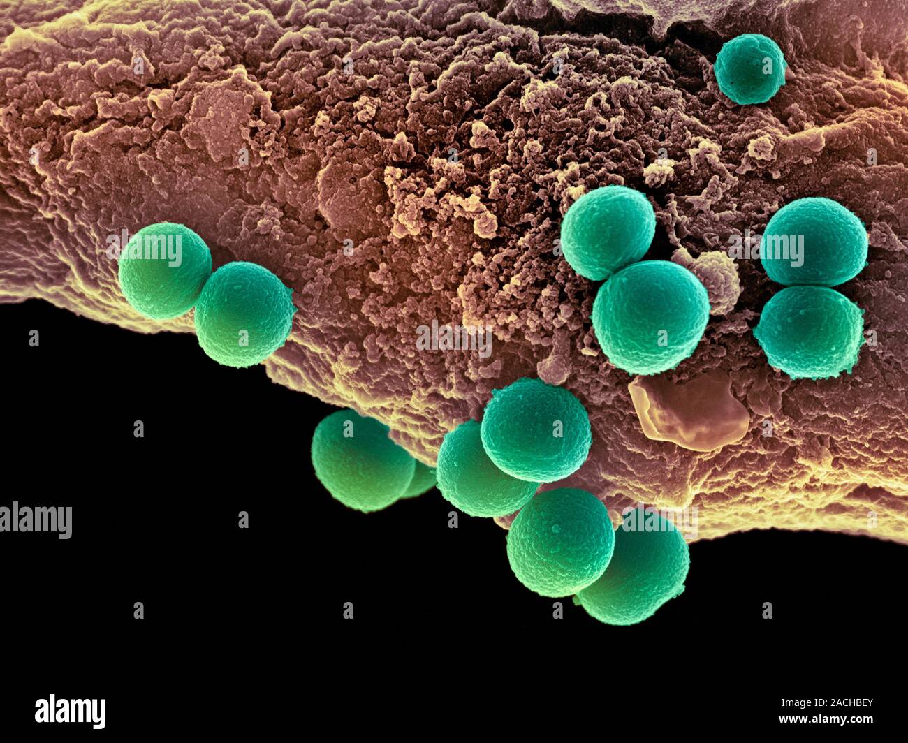 Las Bacterias Staphylococcus Aureus Color Análisis Micrografía De