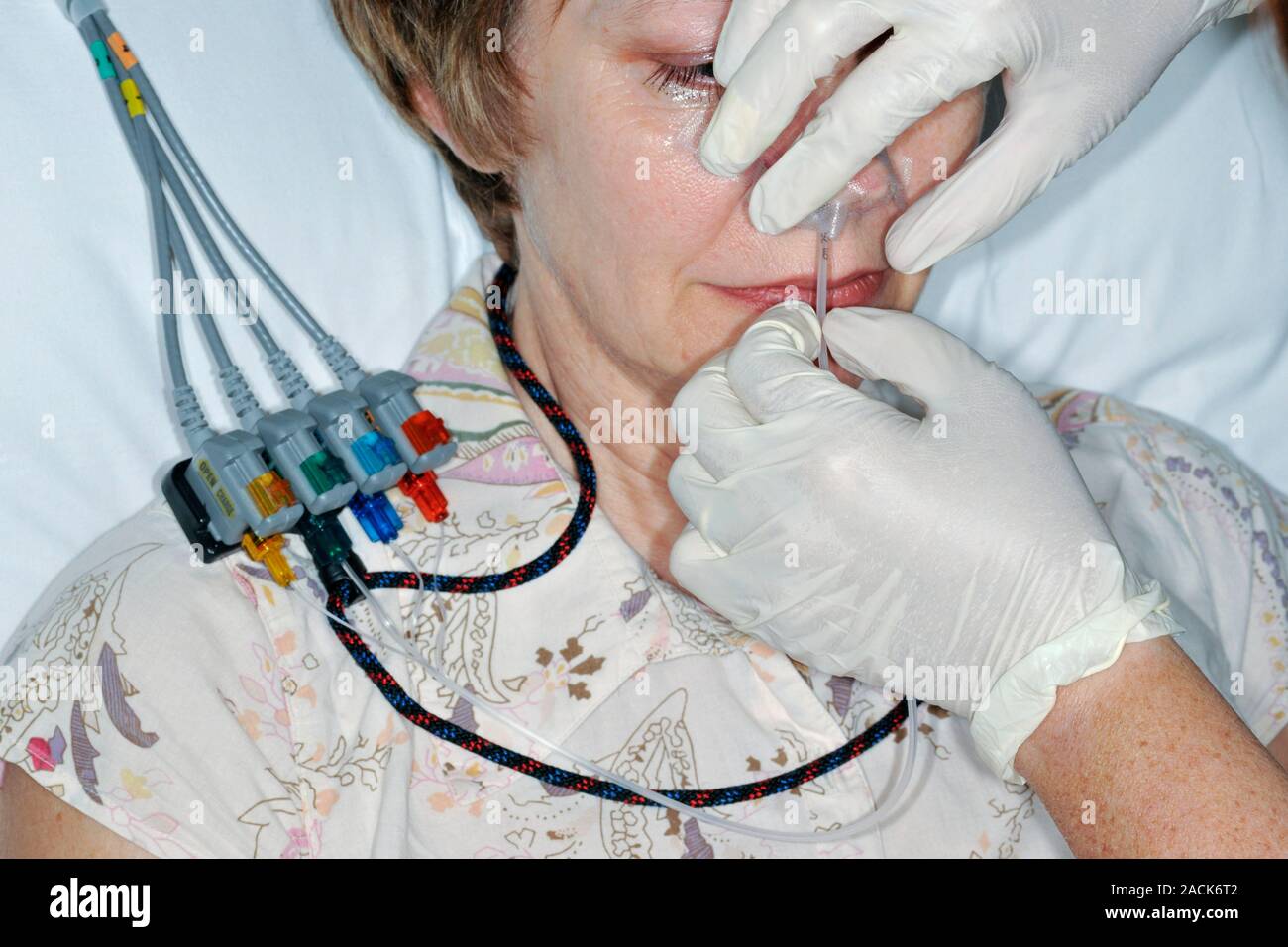 Manometría esofágica y pH testing. Paciente que está equipado con manometría  esofágica y pH el equipo de monitorización. El primero permite el motor  functio Fotografía de stock - Alamy