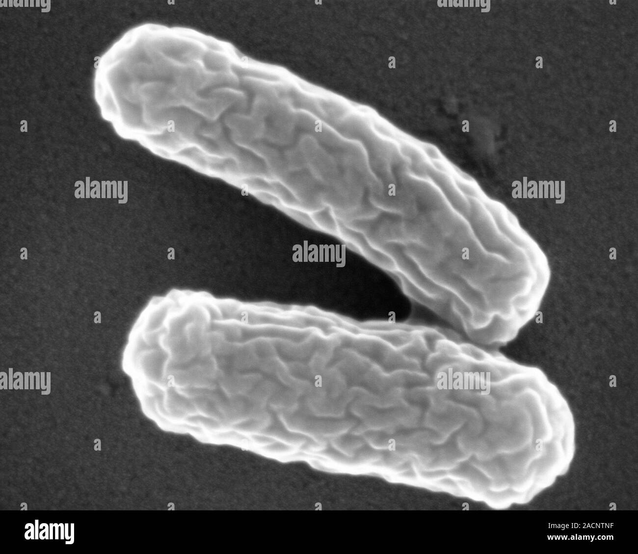 La bacteria Legionella. Color análisis micrografía de electrones (SEM