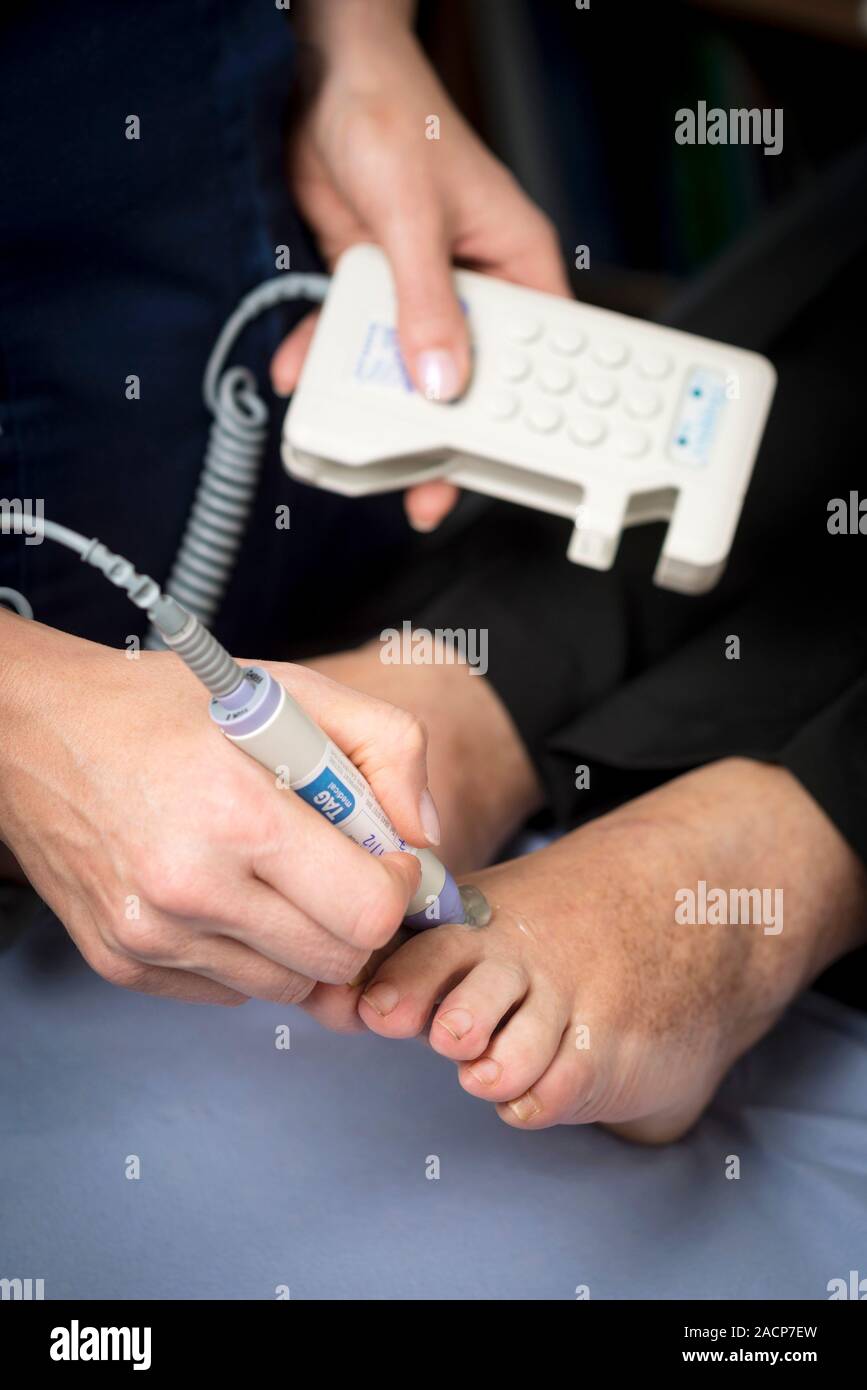 Diabetes clínica, exploración de pie de ultrasonido. Ecografía Doppler que se llevan a cabo para