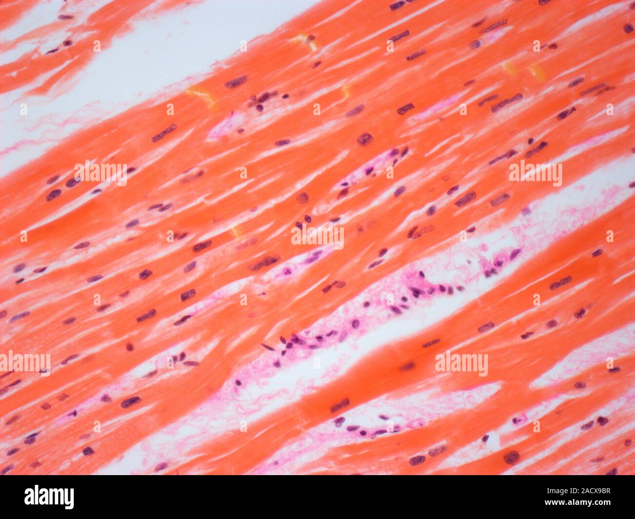 Гладкая мышечная ткань в дерме. Поперечно полосатая сердечная мышечная ткань микропрепарат. Гладкая мышечная микропрепарат. Скелетная мышечная ткань микропрепарат. Сердечная мышечная ткань микропрепарат.