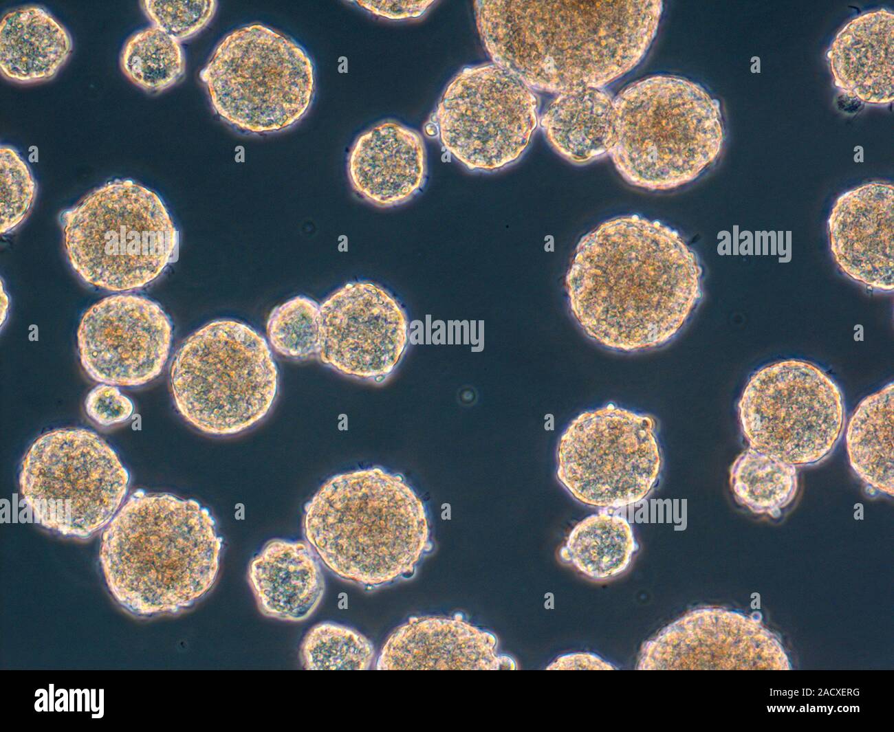 madre derivadas orina, micrografía de luz. Los científicos chinos han publicado método para producir las células madre multipotentes de orina humana. Origen epitelial Fotografía de stock - Alamy