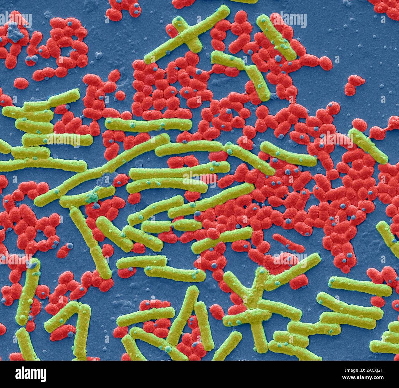 Estreptococo hemolítico y E. coli, color Micrografía análisis de electrones  (SEM). Los estreptococos (rojo) son cocos gram positivos que crecen en las  cadenas. La agr Fotografía de stock - Alamy
