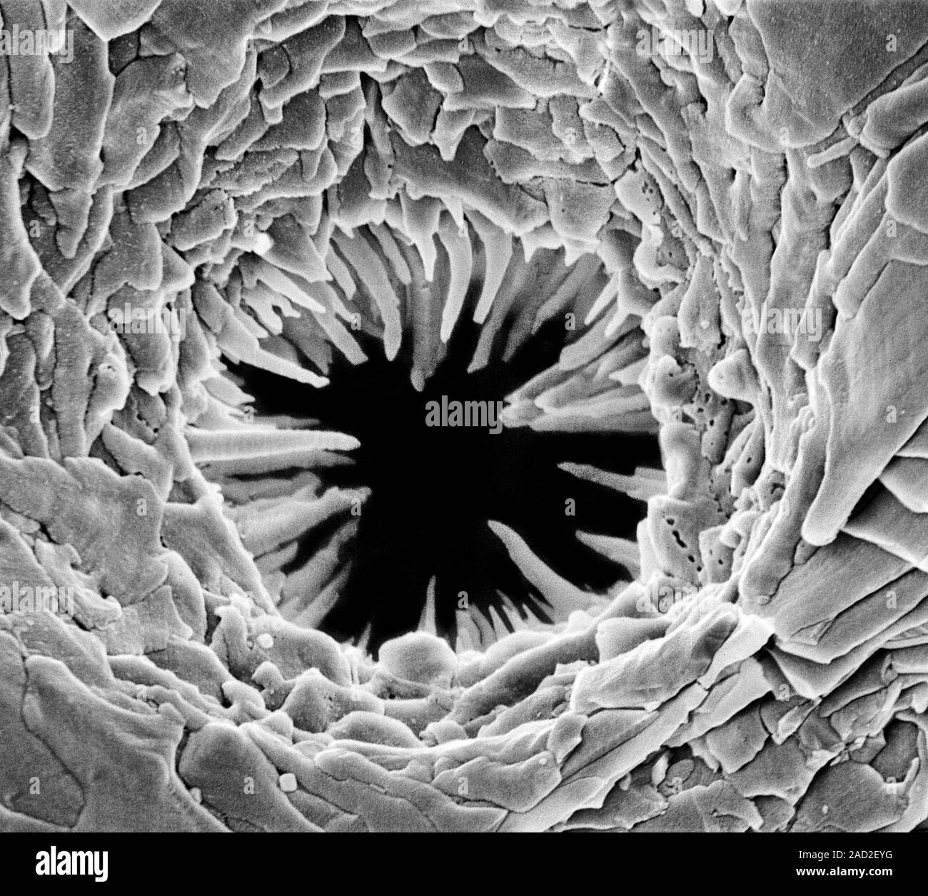 Imagen por microscopio electrónico de barrido de un poro bryozoan  Fotografía de stock - Alamy