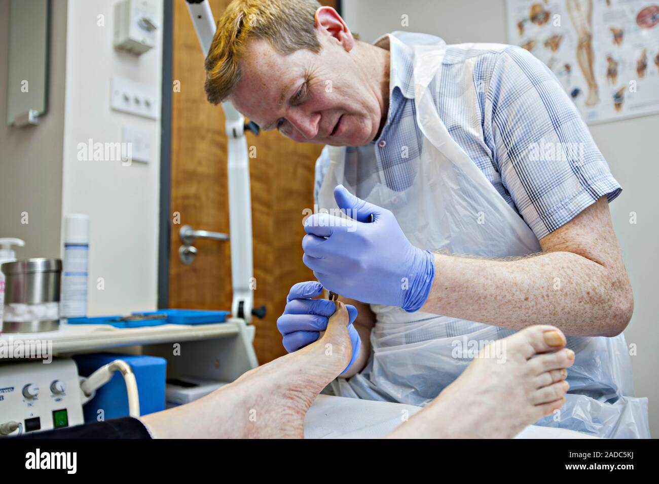 Podología tratamiento. Podiatra usando cortaúñas mientras llevaban a cabo  podología tratamiento sobre los pies del paciente en una práctica general  (GP) clínica. Chir Fotografía de stock - Alamy
