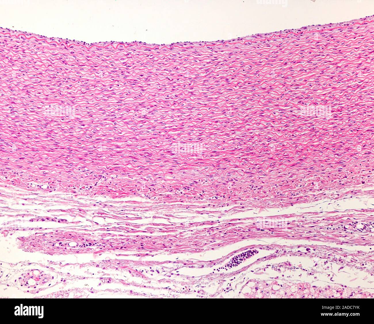 Sección transversal de una arteria elástica mostrando las capas de su  pared, luz micrograph. La túnica media, ricos en hojas o láminas elásticas,  ocupa mo Fotografía de stock - Alamy