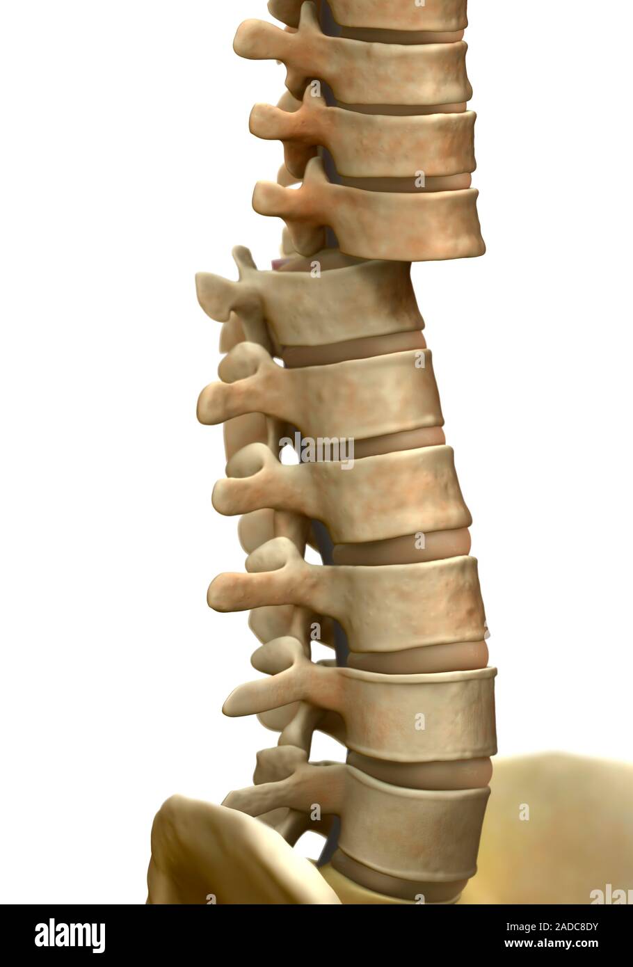 Columna vertebral rota. Ilustración de un acercamiento de la región  toraco-lumbar de la columna vertebral humana con una rotura en la columna  vertebral (centro). La parte delantera o Fotografía de stock -