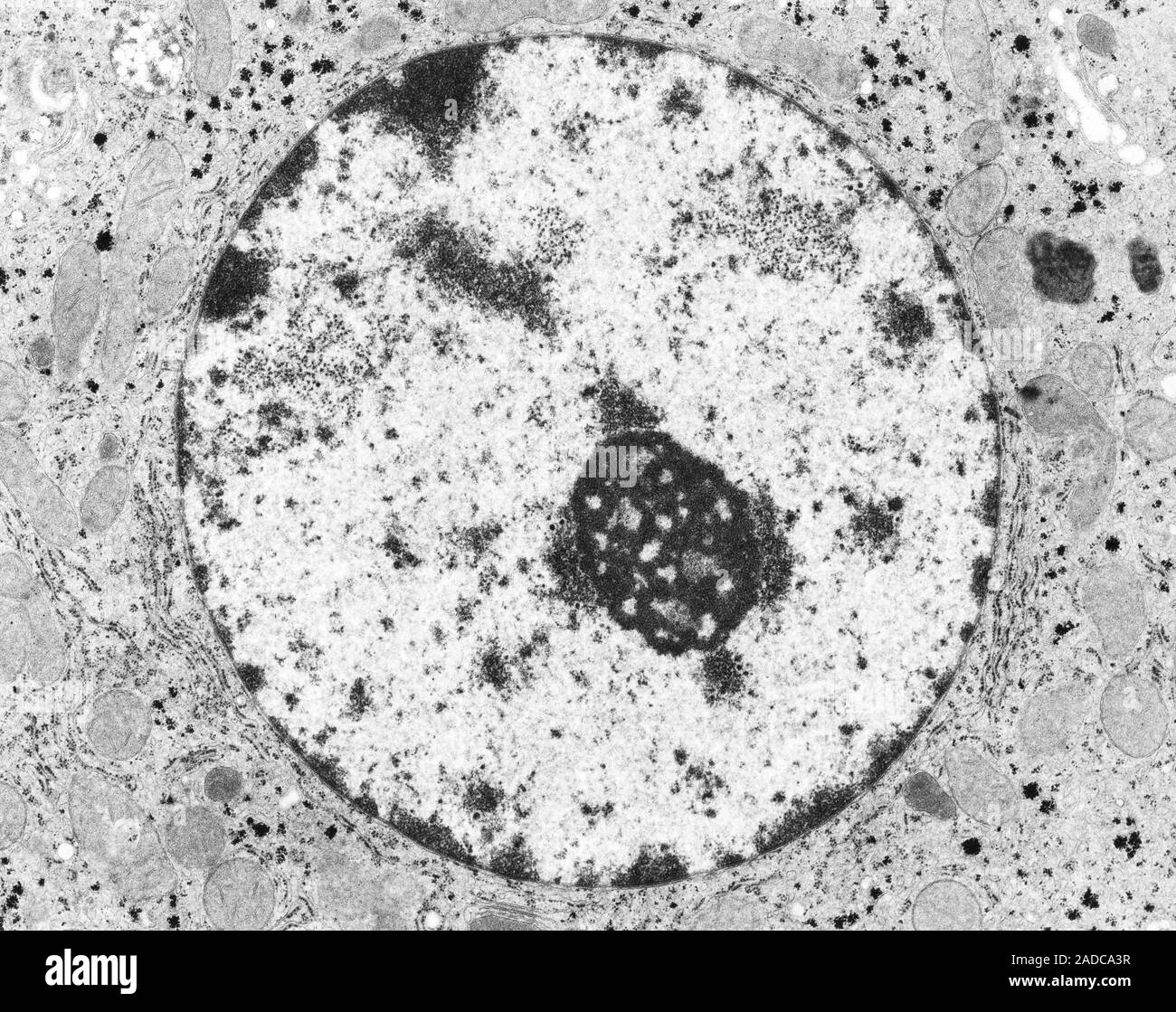 Las células hepáticas (hepatocitos) núcleo con ADN (ácido ...