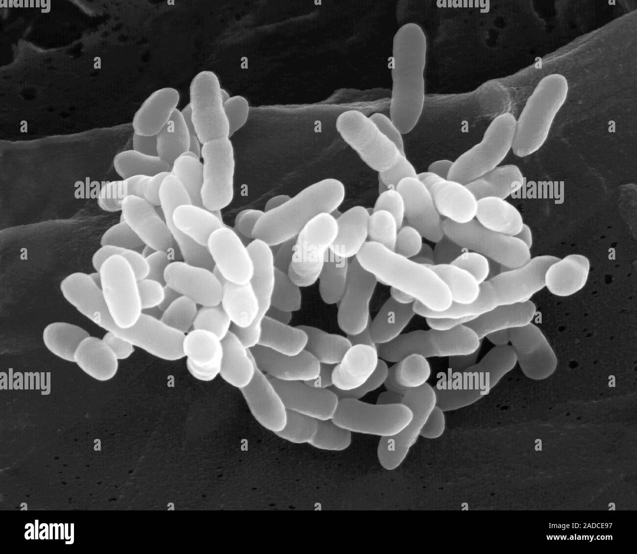 Болезнетворные бактерии кишечная палочка. Бактерии сапрофиты. Бактерии сапрофиты. Сапрофиты микроорганизмы. Бактерии сапротрофы.