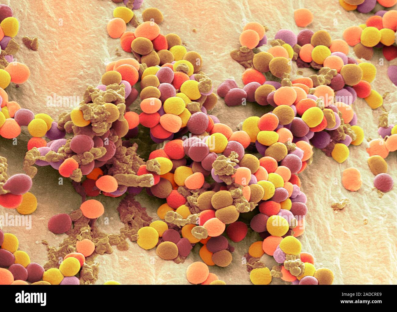 Стафилакока. Золотистый стафилококк анаэроб. Staphylococcus aureus анаэроб. Бактерии стафилококки. Giant Microbes стафилококк золотистый.