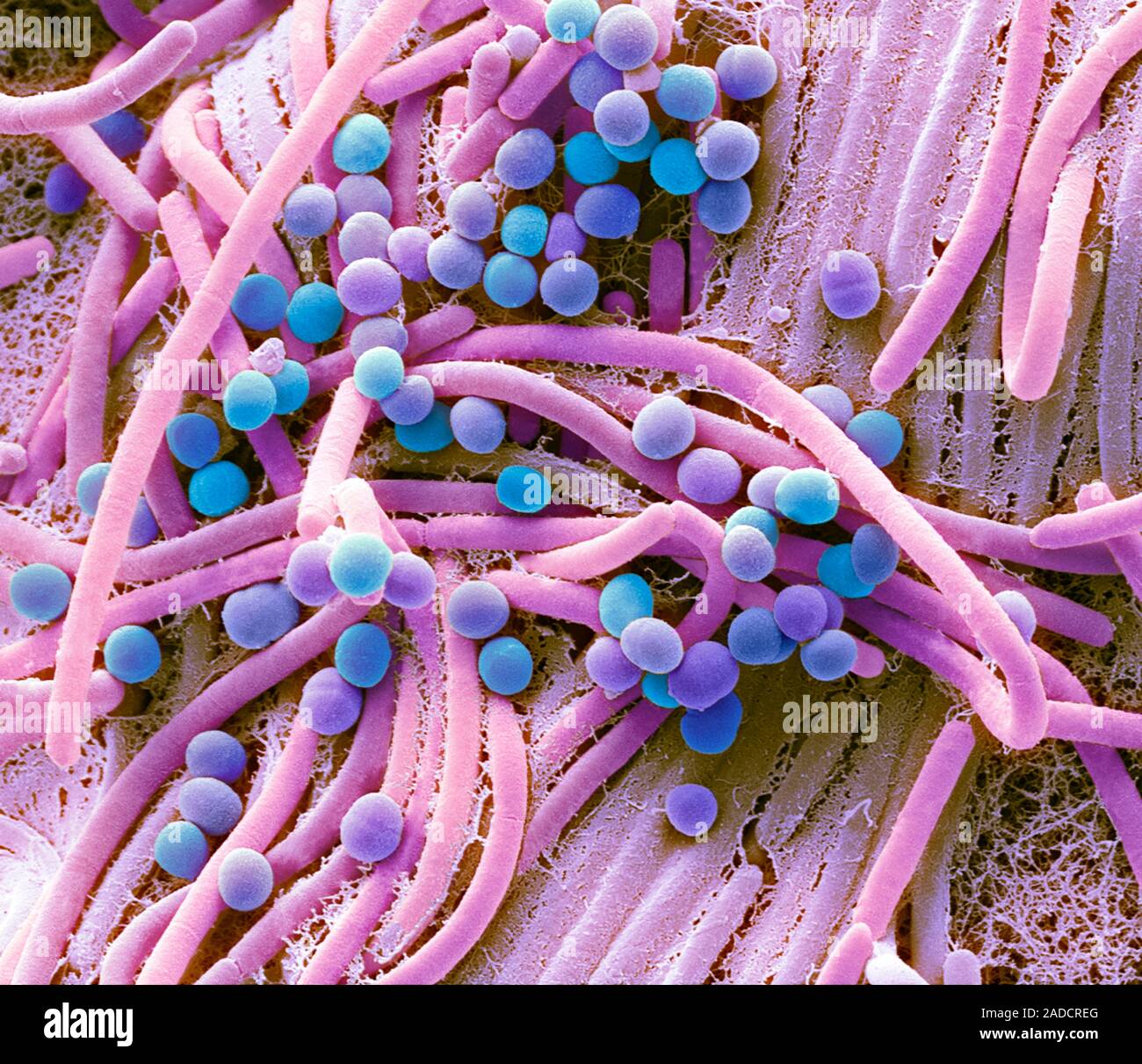 Las bacterias fecales. Análisis micrografía de electrones (SEM) de bacterias  cultivadas a partir de una muestra de heces humanas. Al menos el 50% de las heces  humanas es hecho u Fotografía de