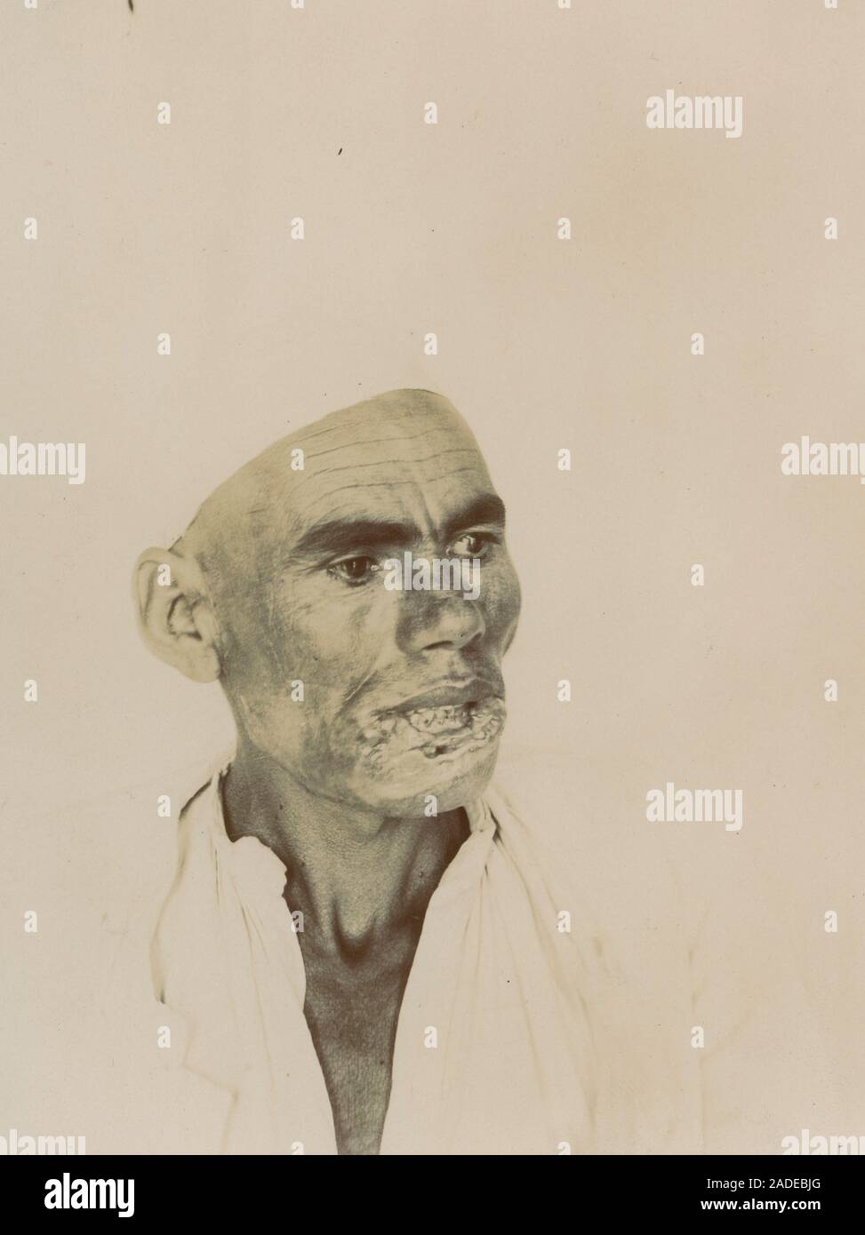 La desfiguración facial, imagen histórica. Las causas de tales