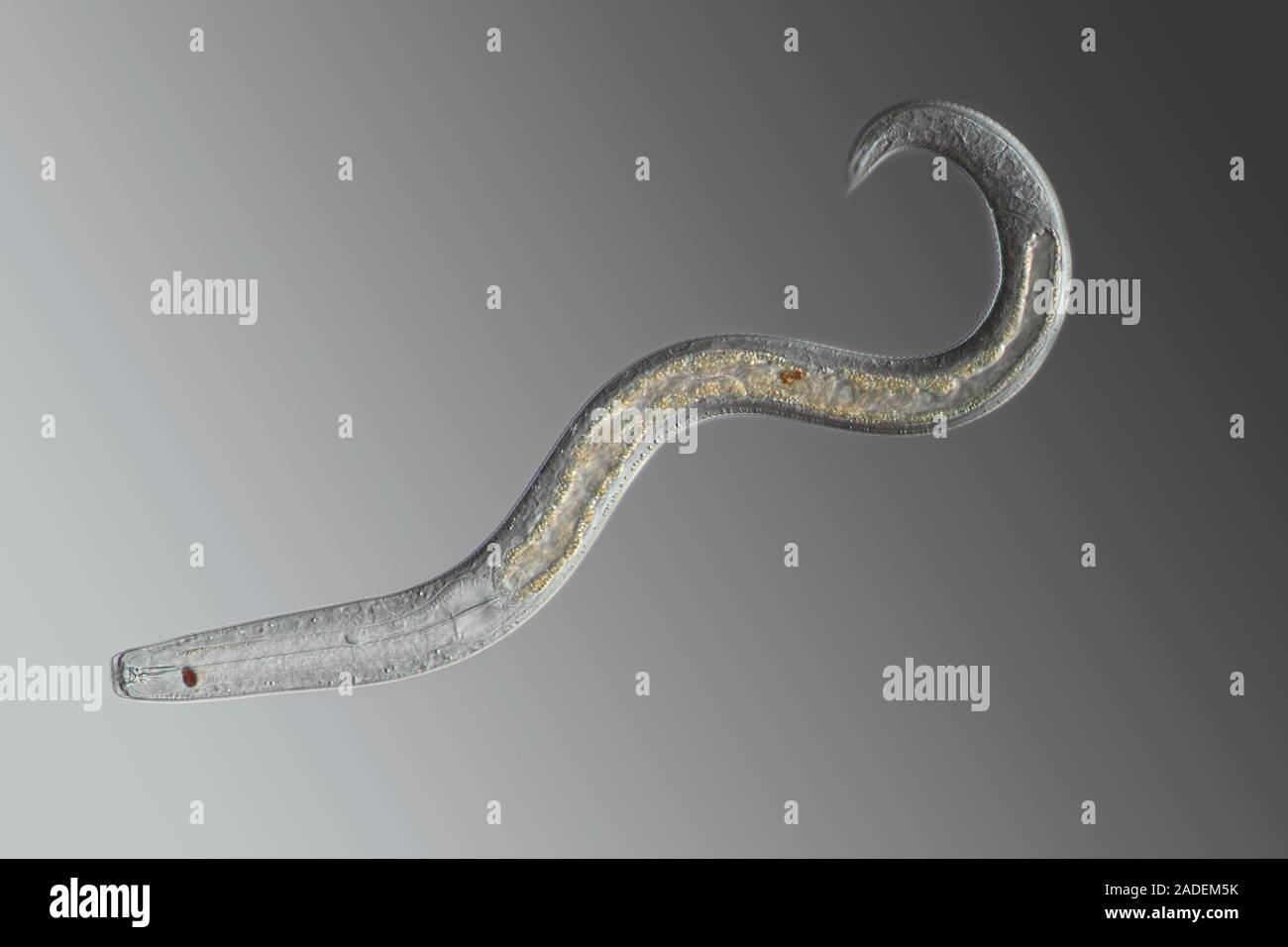 Gusano nematodo, micrografía de luz. Los gusanos nematodos son pequeños gusanos que están sin Gusano nematodo, micrografía de luz. Los gusanos nematodos son pequeños gusanos que están sin