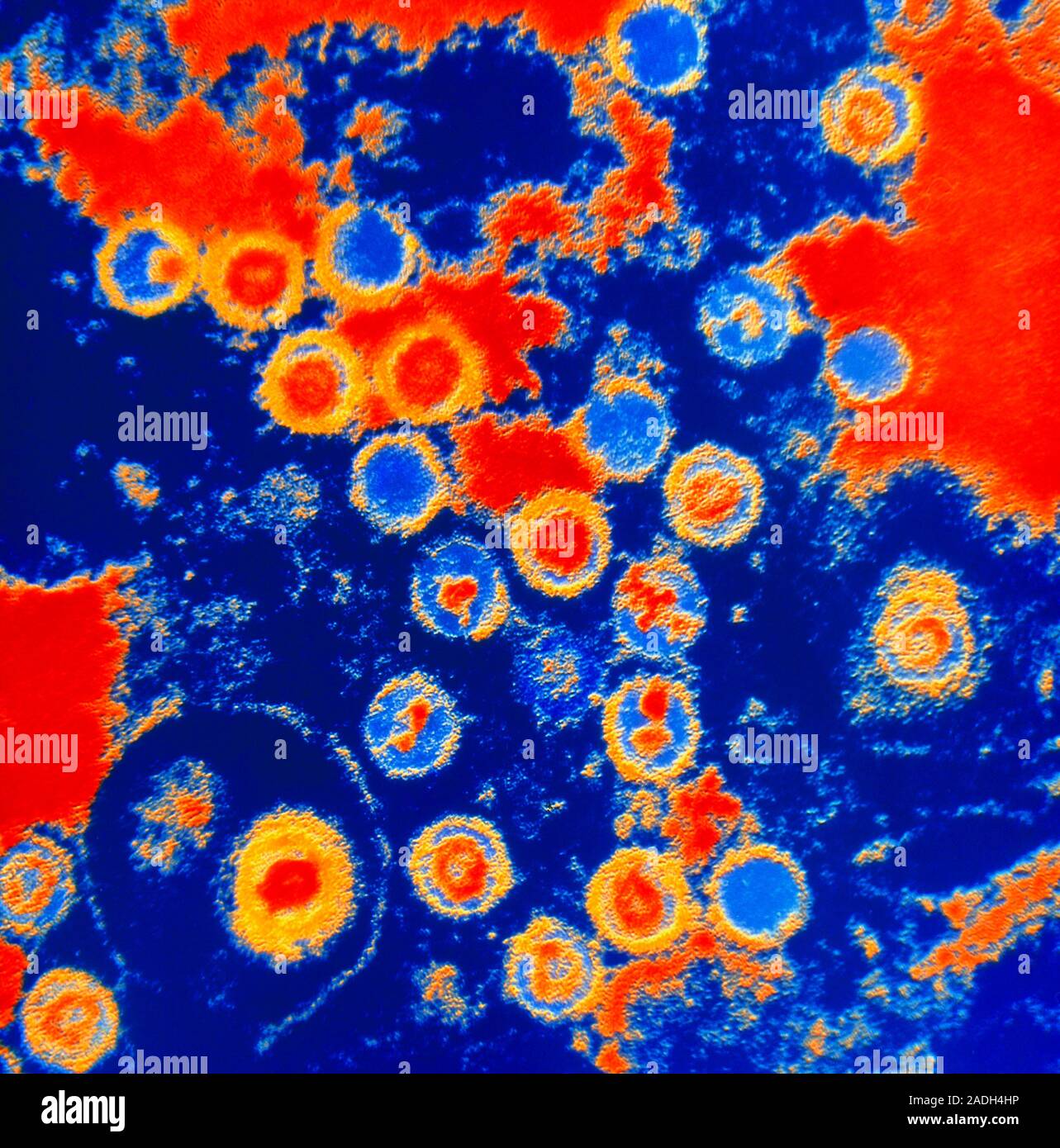 Virus de EpsteinBarr (VEB). Color micrografía de electrones de la