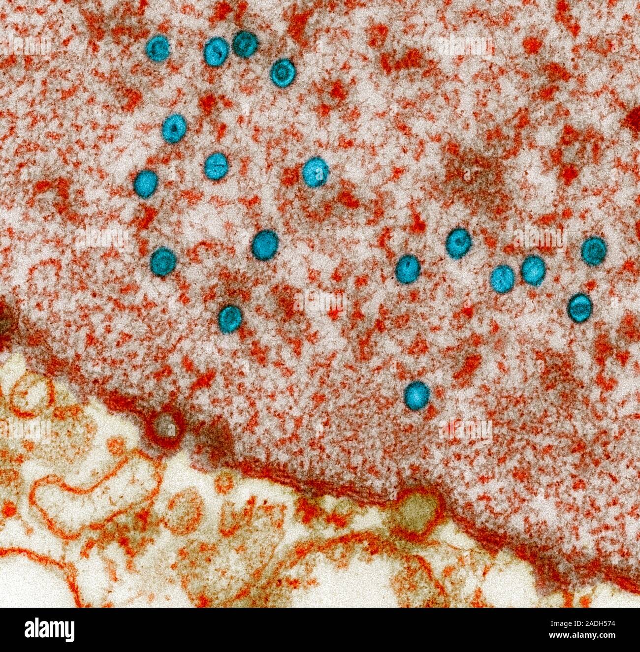Las partículas de virus de EpsteinBarr. Color micrógrafo electrónico