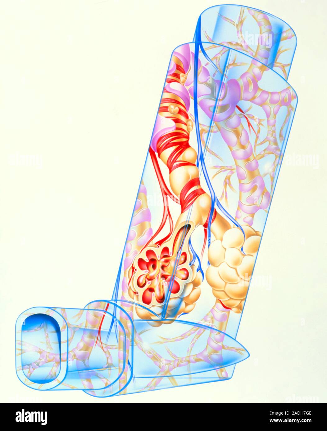 El asma. Ilustración de la parte del sistema respiratorio, visto en un ...