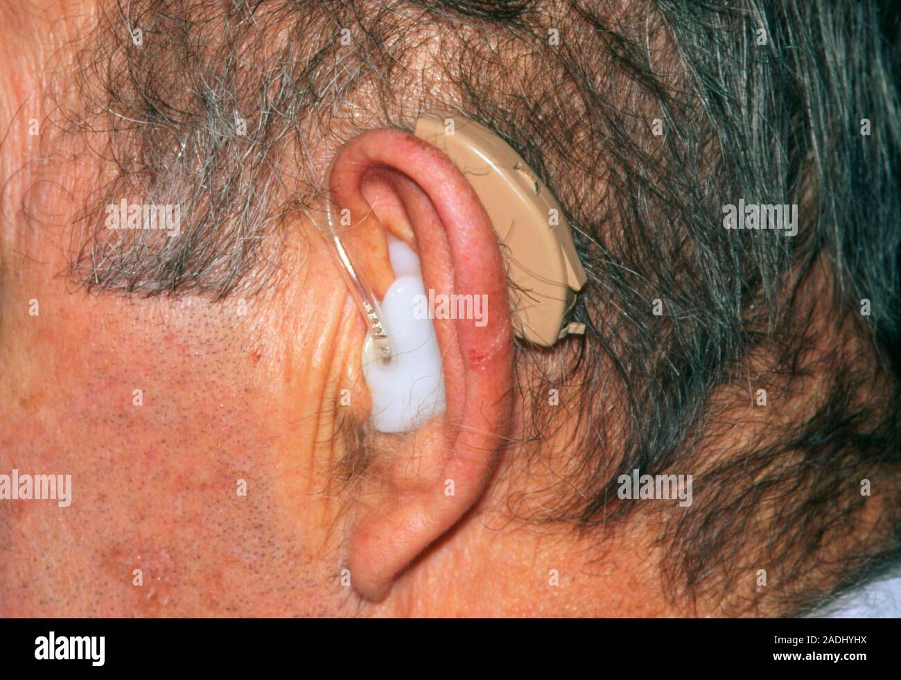 Audífonos. Cerca de la oreja de un hombre en la vista lateral, mostrando  una audífonos. Este audífono está colocado detrás de la oreja; tiene una  rueda para marcar Fotografía de stock -