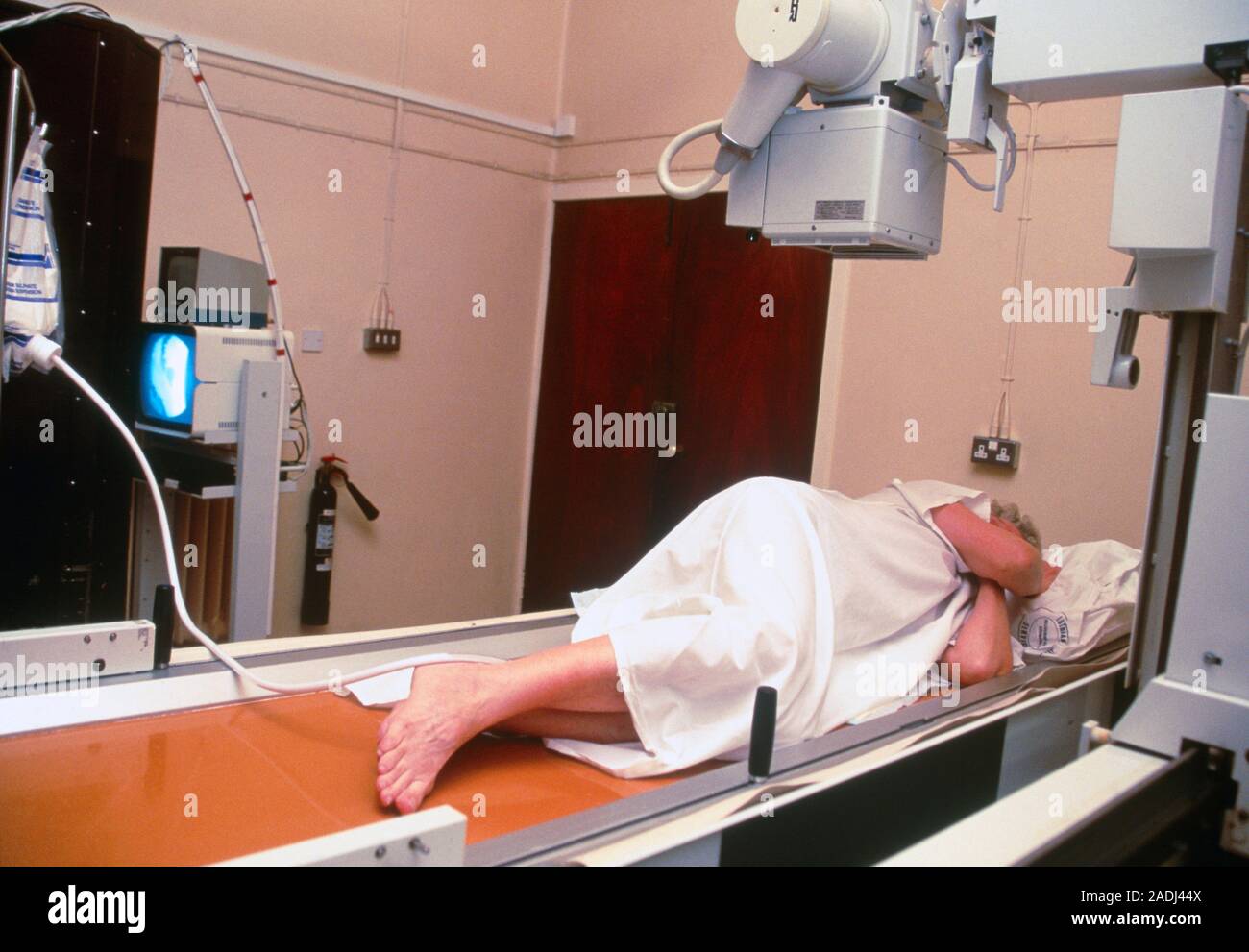 Radiografía con enema de bario. Ancianas paciente sometido a un estudio