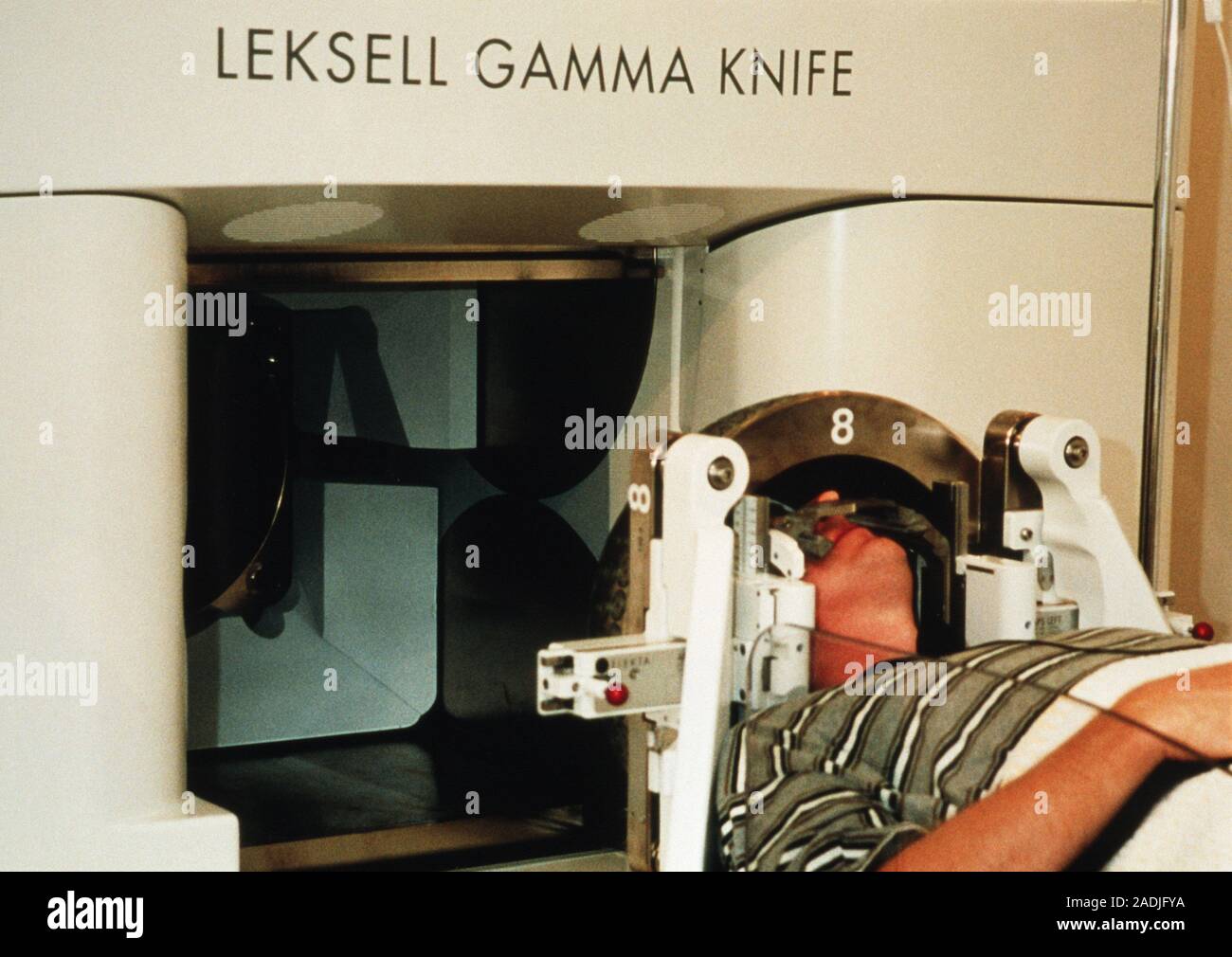 Gamma Knife radioterapia. Paciente sometido a radioterapia con bisturí