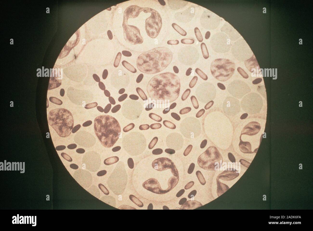 Peste bubónica bacterias. Ilustración histórica de pus de un paciente con  peste bubónica vistos bajo el microscopio de luz. En el pus son Yersinia pe  Fotografía de stock - Alamy
