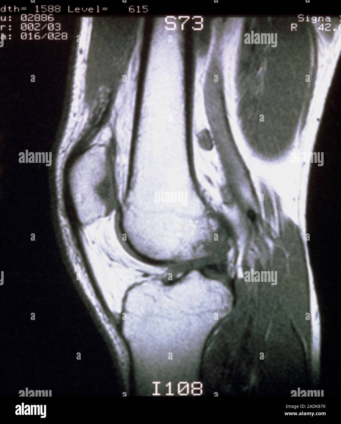 Imágenes de resonancia magnética (MRI) de una sección sagital (perfil