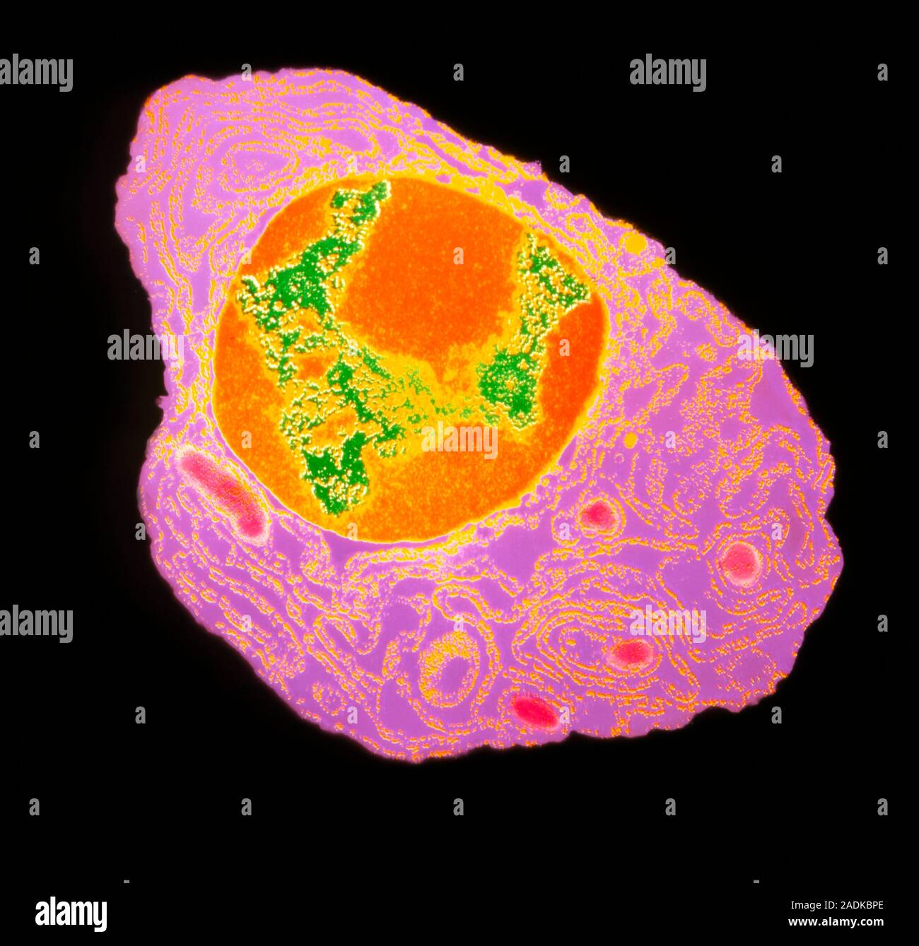 Célula plasmática. Transmisión Color micrografía de electrones de células plasmáticas de la