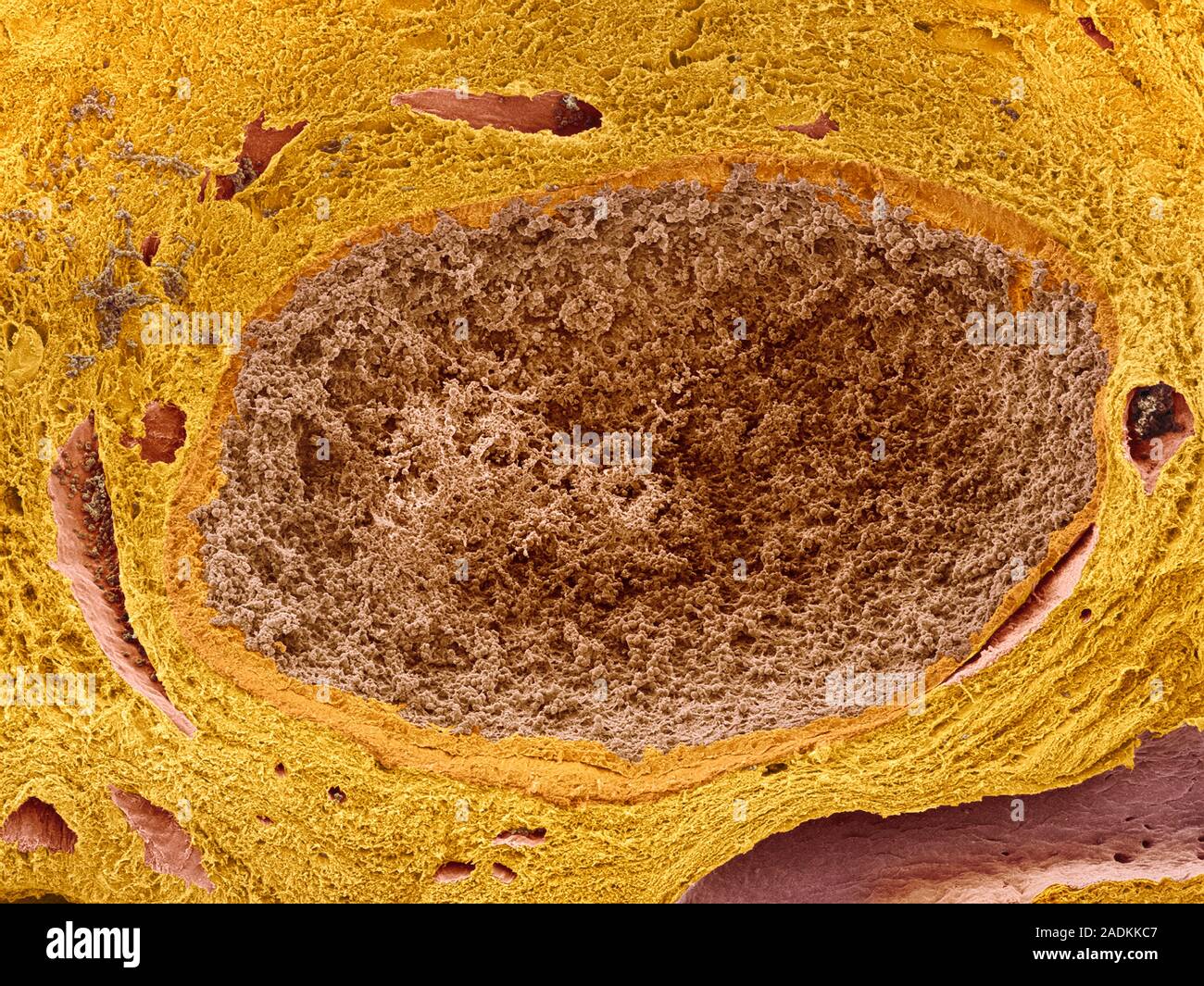 Cuerpo lúteo. Color análisis micrografía de electrones (SEM) de un