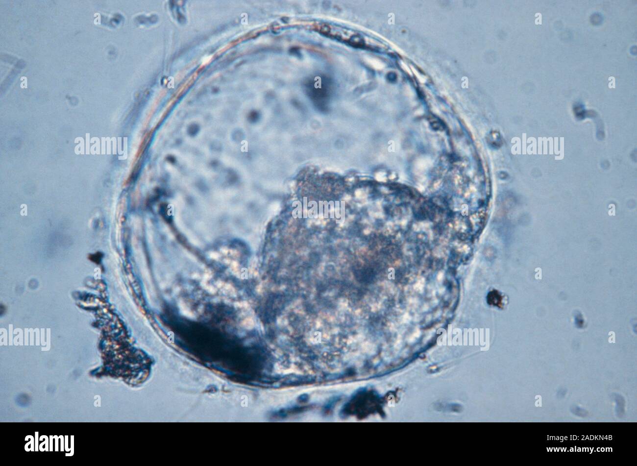 Micrografía de luz de iluminación (Kohler) de un blastocisto humano, una  etapa temprana de desarrollo embrionario, fotografiado durante 4-5 días  después de la fertilización. El Fotografía de stock - Alamy