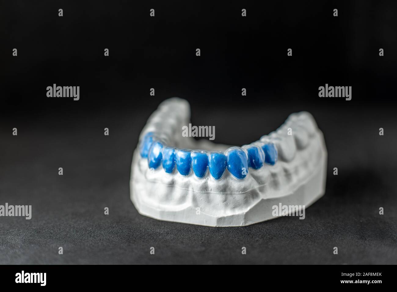 Cerca en yeso modelo artificial de la mandíbula con los dientes pintados de azul y tapa transparente sobre el fondo negro Foto de stock