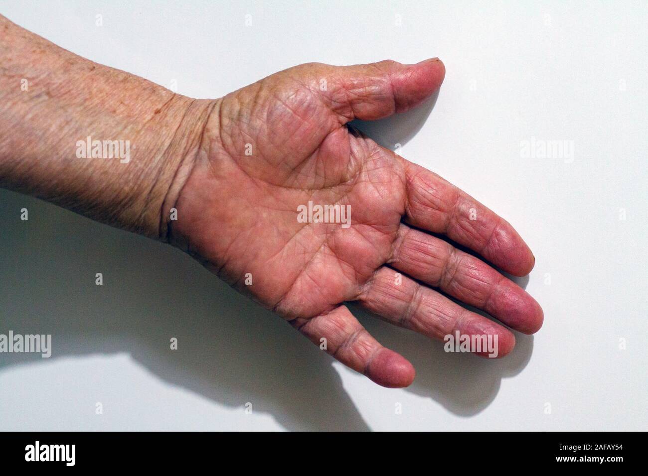 El proceso de envejecimiento de la piel humana - arrugadas manos de un  hombre que vivió muy antiguo 90-100 años con piel seca cubierto con las  arrugas y manchas Fotografía de stock - Alamy