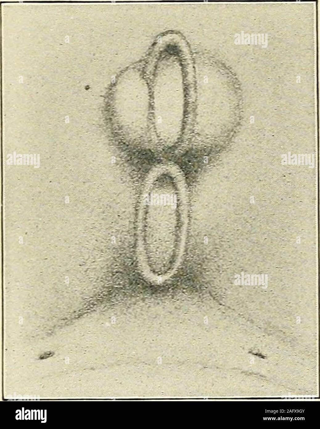 Prostate hypertrophy fotografías e imágenes de alta resolución - Página 2 -  Alamy
