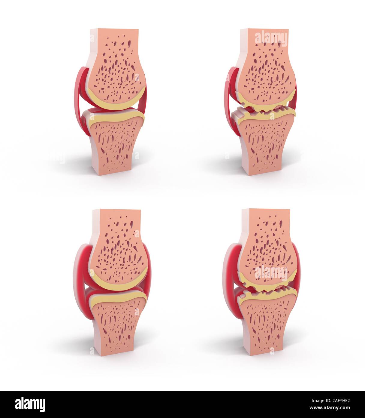 Ilustración 3d de sana y esféricos conjunta sinovial. En cuatro representaciones permanentes y aislado sobre fondo blanco. Foto de stock