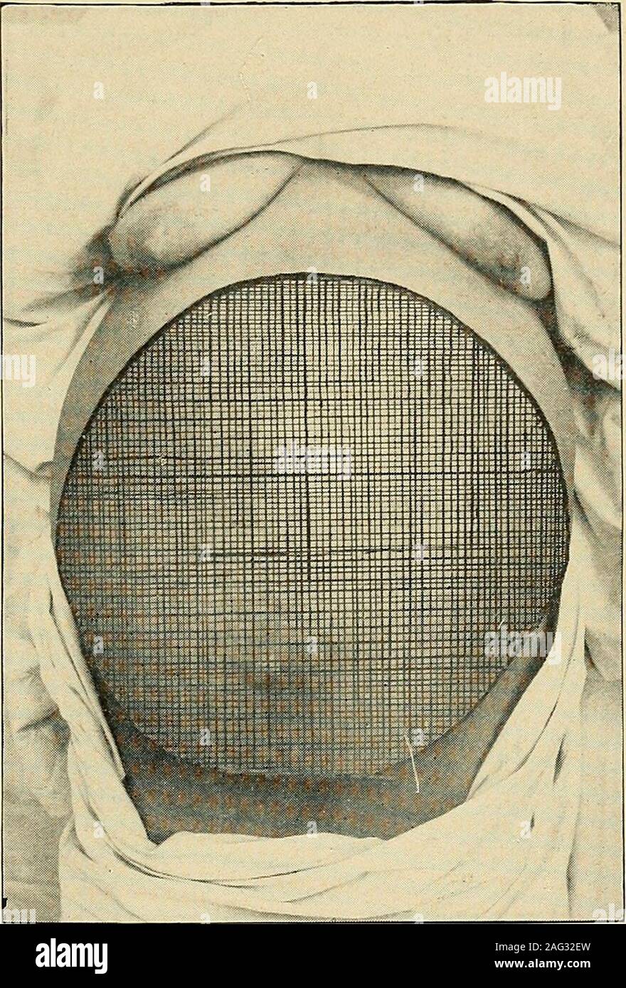 . El diagnóstico y tratamiento de enfermedades de la mujer. Fig. 181