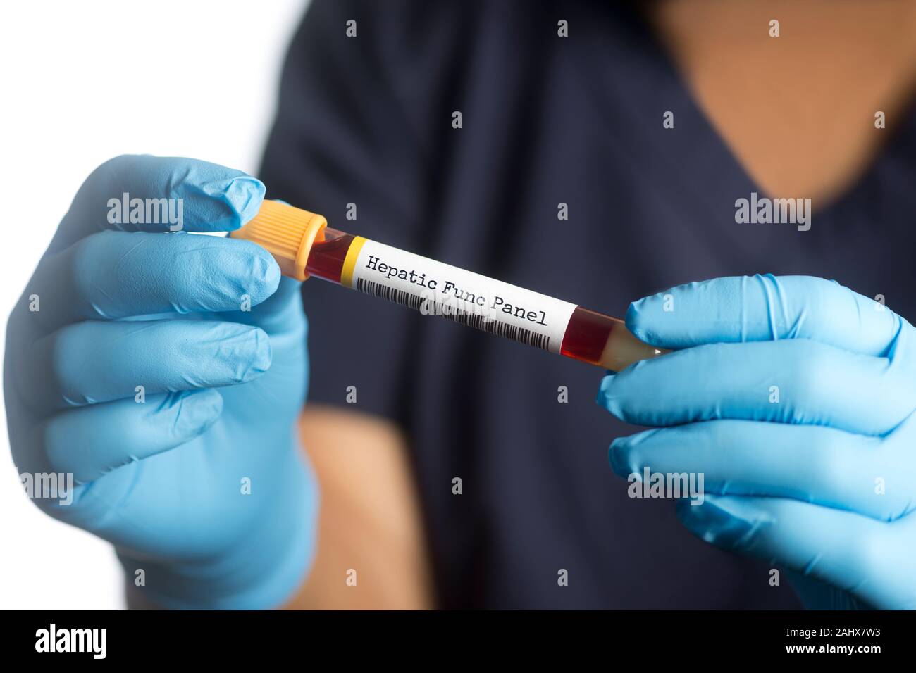 El panel de la función hepática examen de sangre el tubo. Esta prueba de sangre puede ser útil en la evaluación de la función hepática, así como por ciertas enfermedades hepáticas Foto de stock
