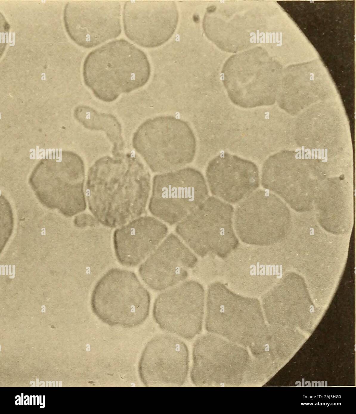 Reproducción Celular Inducida Y El Cáncer Fig 7 Los Leucocitos Granulados Están Manchadas Su Núcleo Está