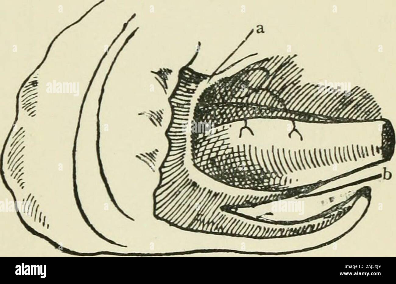 Algunos puntos de la anatomía, la patología y la cirugía de la  intususcepción . bution;a veces mienten paralelo al colon, en ocasiones  paralela a theileum, y a veces no tienen ningún arreglo