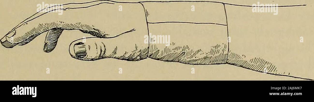 Codo extendido fotografías e imágenes de alta resolución - Alamy