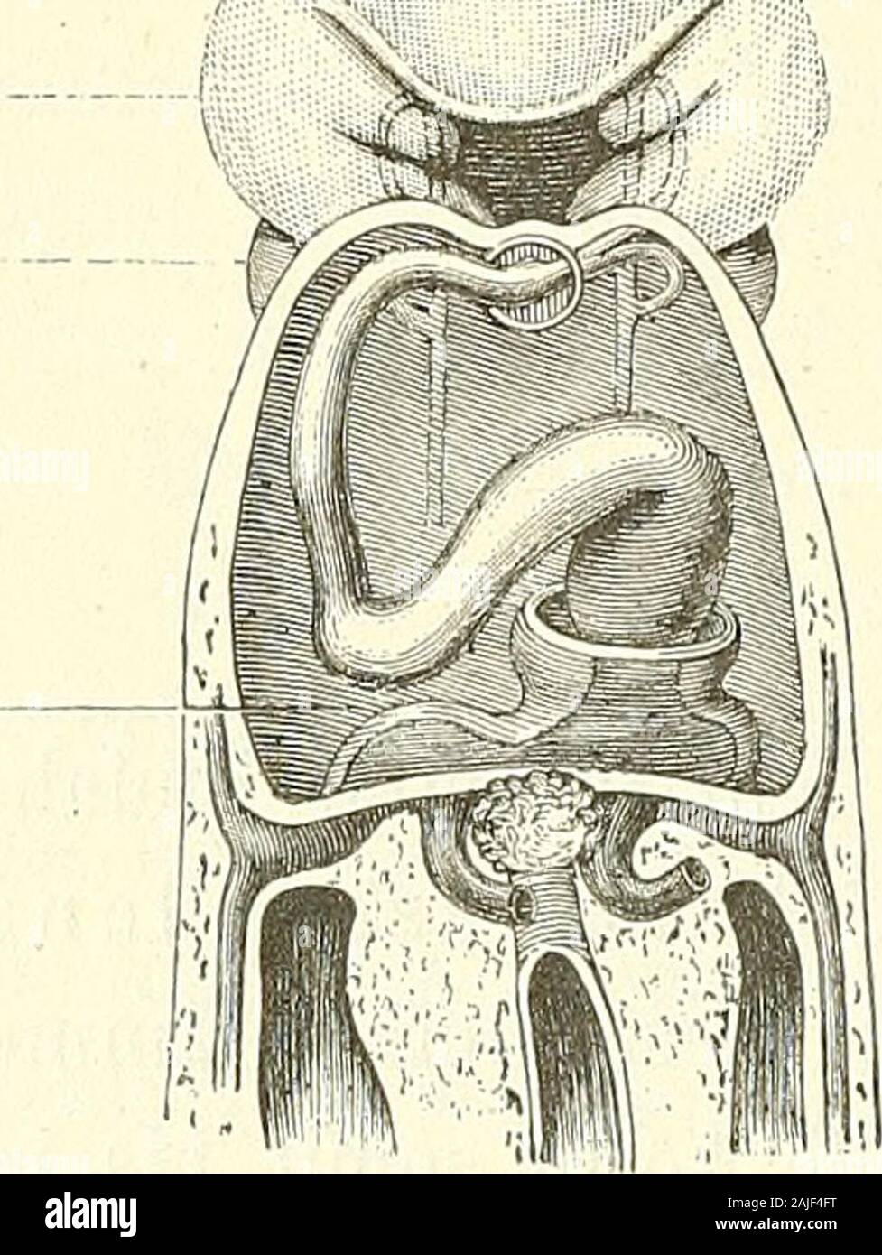 Anatomie menschlicher Embryonen . nats eingeleitet, mit 5 Wochen beiSeh vollzogen. Obere Das Ende des Aortentruncus inserirt sich, cerquero Ent-stehung gemäss, en die Vorderwand des Mundrachenraumes, undzwar liegt bei den jüngsten Stufen von Lg und der Rf Insertionsortim einspringenden Winkel unter der Yerbindungsstelle der beidenUnterkieferbogen, zur Hälfte noch en deren Bereich, zur Hälftein demjenigen des zweiten Bogenpaares. (Man vergleiche ausser dernachstehenden Eig. 119 die figuren 1, 2, 6, 7 und 8 von taf. IX.)En dieser Zeit des Endothelschlauch setzt sich der tronco jeder-seits en zwei Foto de stock