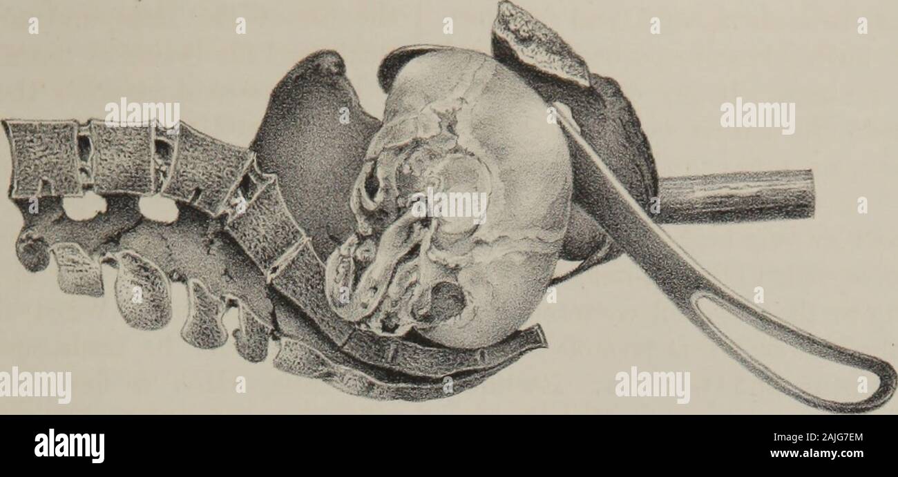Occipucio anterior fotografías e imágenes de alta resolución Alamy