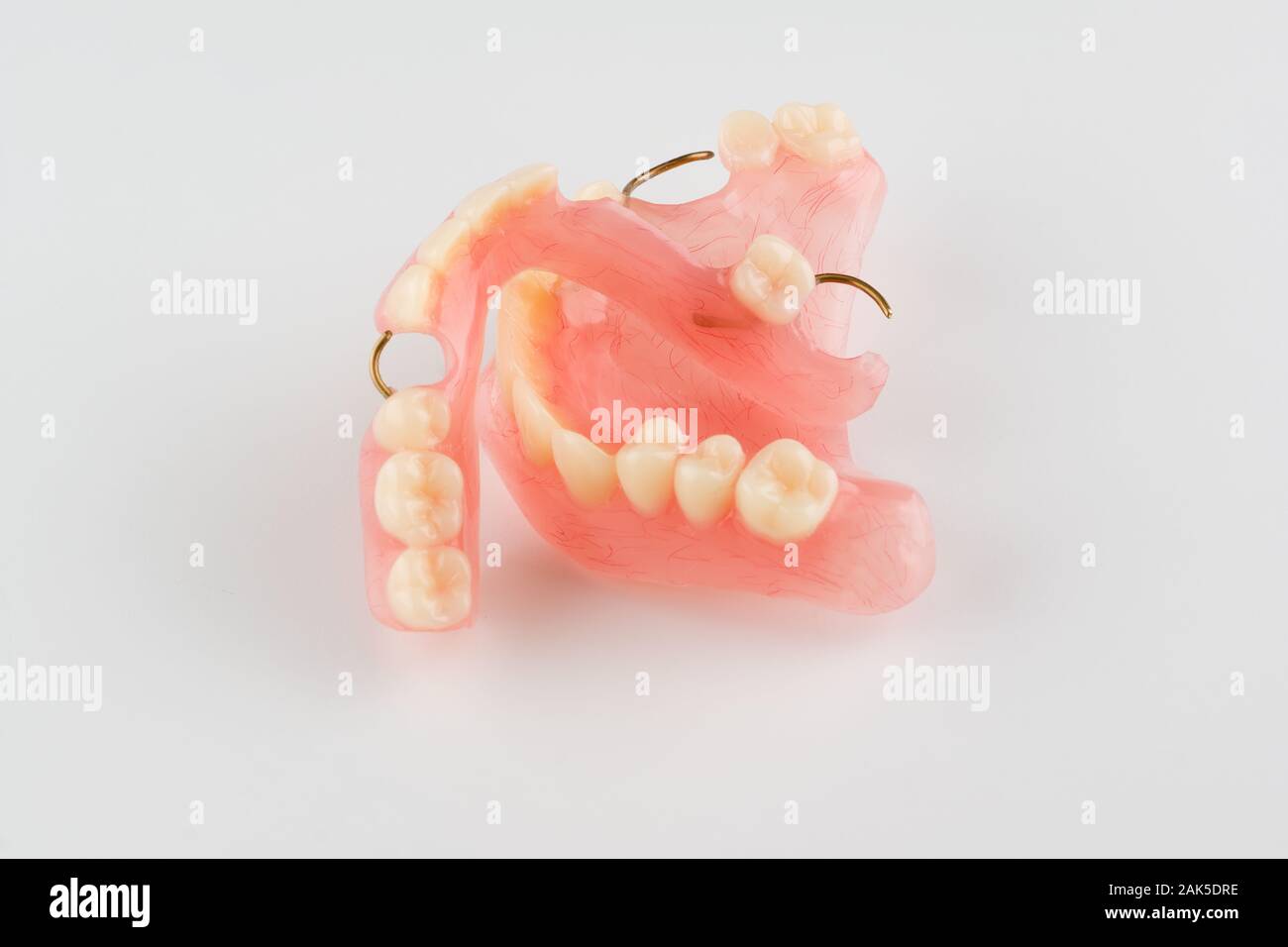 Prótesis dentales de acrílico con elementos de sujeción de metal Fotografía  de stock - Alamy