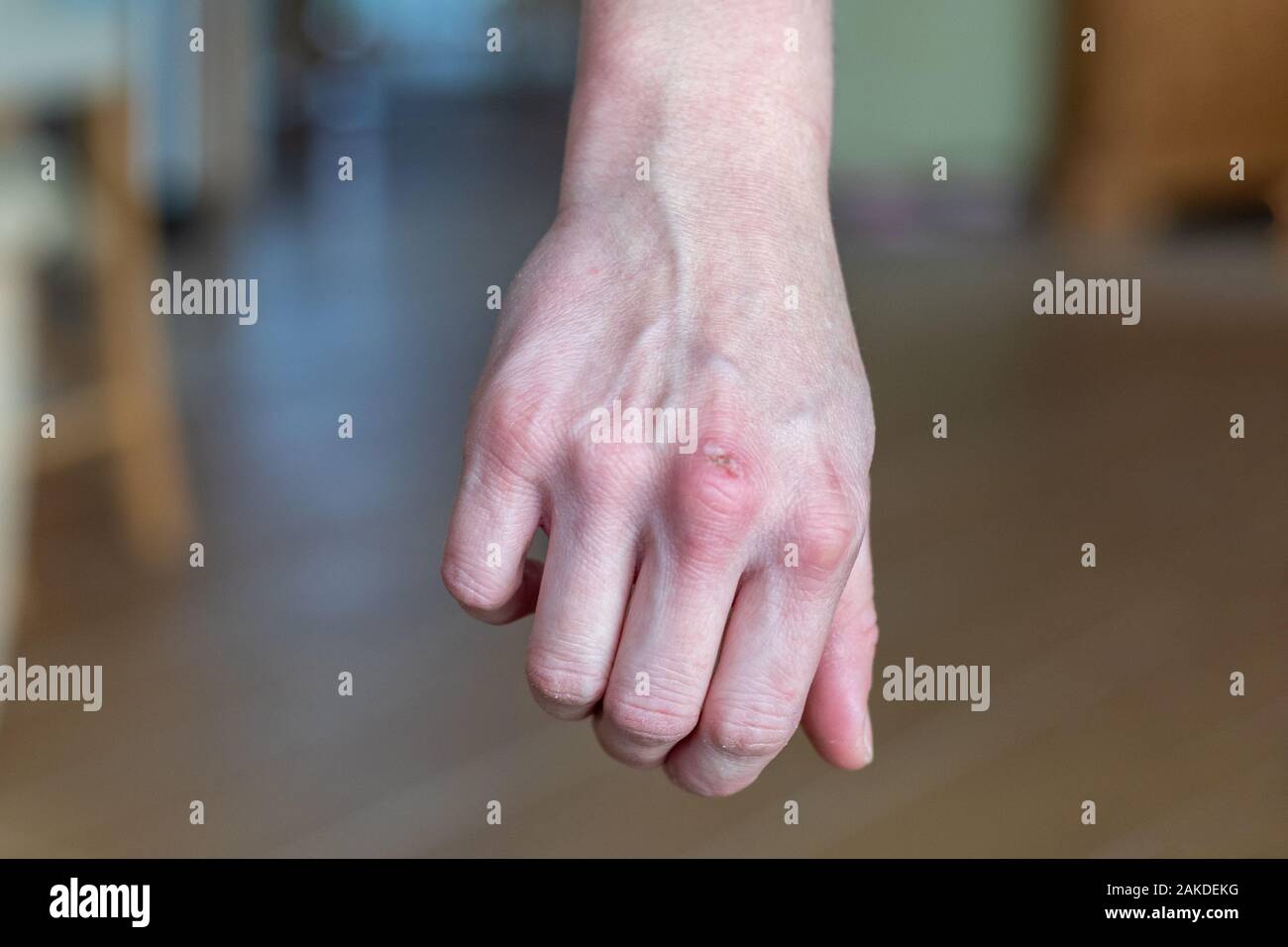 Nasty desagradable quemadura en la mujer de mediana edad de la mano del  descuido de la manipulación el horno caliente Fotografía de stock - Alamy
