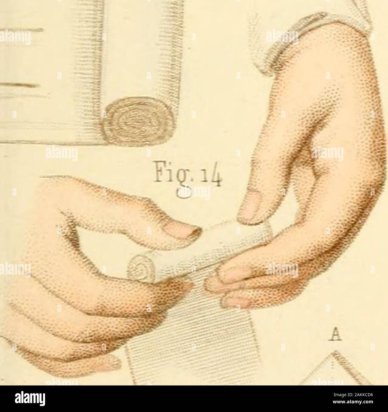 Manual de vendajes quirúrgicos, dispositivos y vendajes . Ficha MEQUIG. 6.  Fkr.4 Fig-. 5. Ficr.6. Fig. I 1 T. Fi&LT;£ 17. %^ FlQ 2 0. Fig-. 18  Fotografía de stock - Alamy