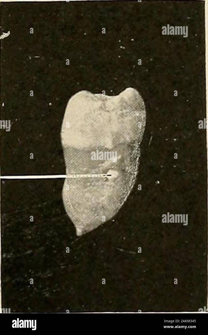 Sección De Un Molar Fotos e Imágenes de stock - Alamy