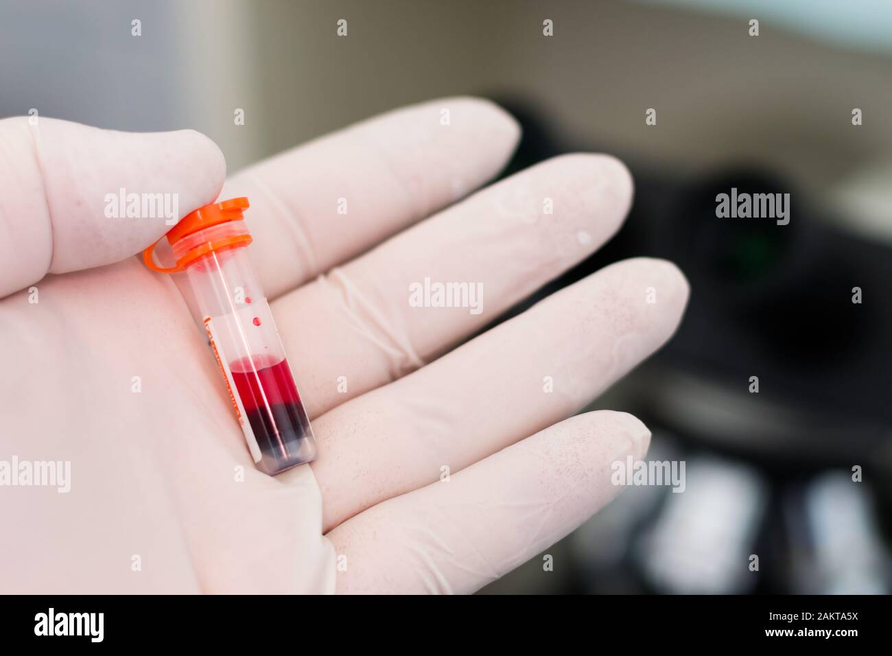 Sangre hemolizada fotografías e imágenes de alta resolución Alamy