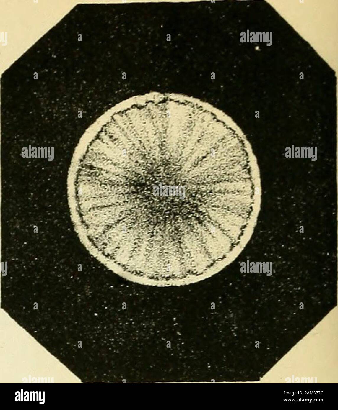 Inflamaciones de la vessie et catarrhe, gravelle, des divers moyens de combattre ces afectos . Foto de stock