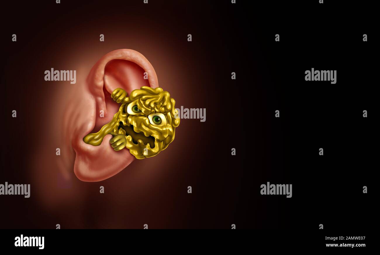 Concepto de cera para los oídos como pérdida de audición debido a la obstrucción de la cera para los oídos en la anatomía interna como una sustancia asquerosa y monstruosa cerosa con elementos de ilustración 3D. Foto de stock