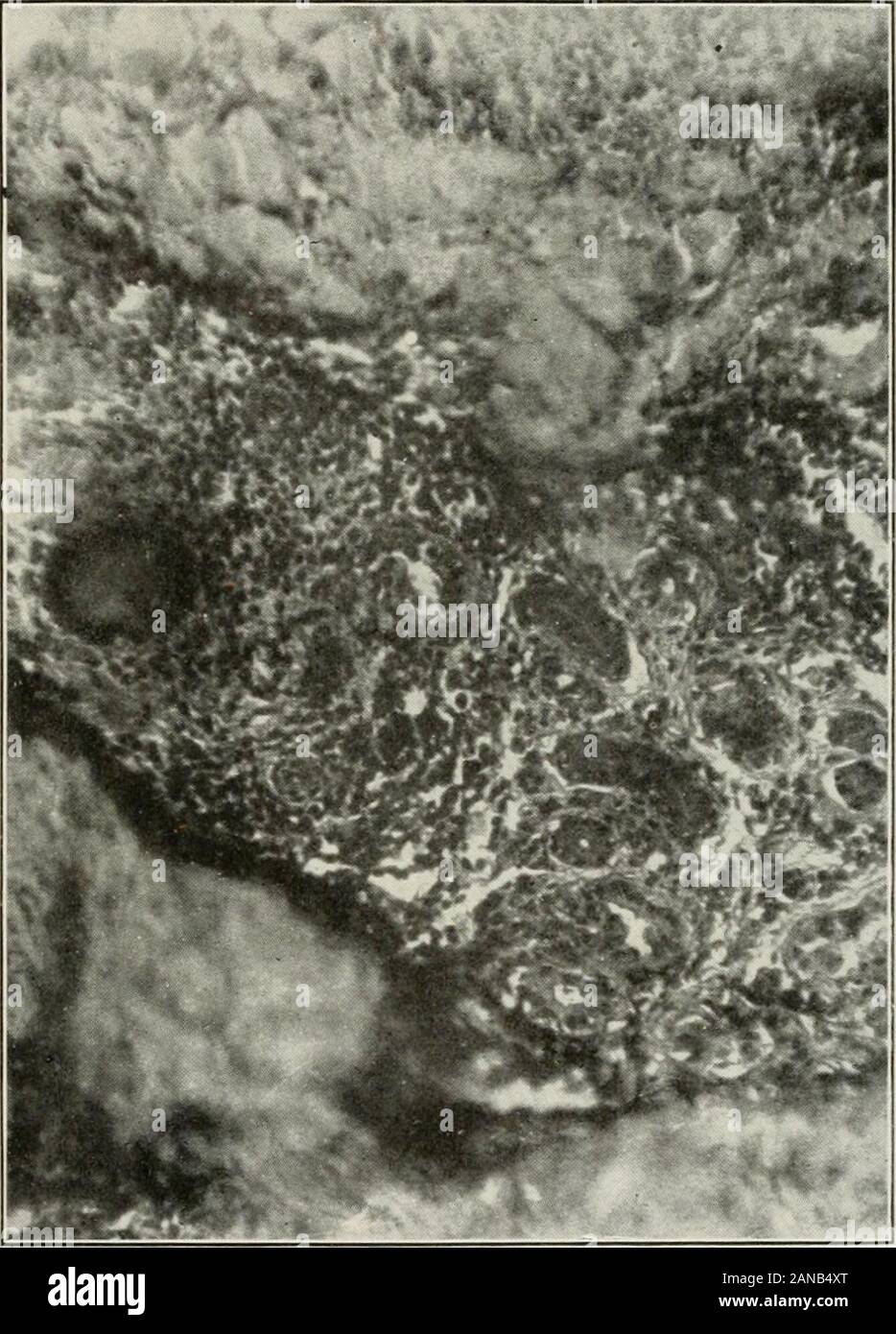 Archives Of Internal Medicine Nuestro Sc 1906 I 1 5 Scheube B Las Enfermedades De Los Paises Calidos Ed 2 Filadelfia 1904 P Hijo Blakistons Co Y 6 Carini A Y