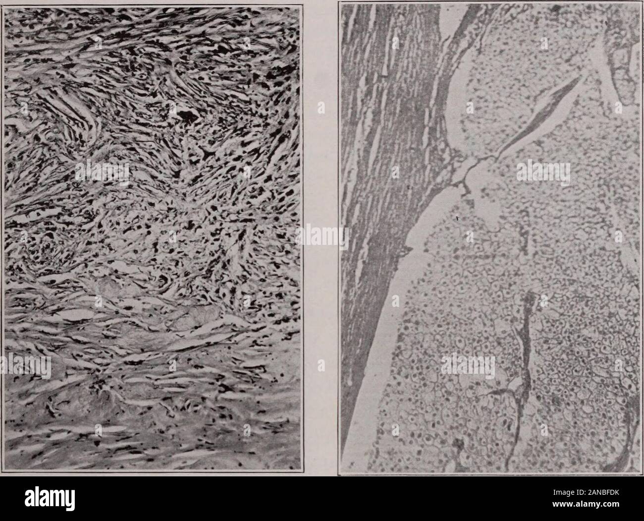 Cuerno de cazador fotografías imágenes de alta resolución Página 2 -