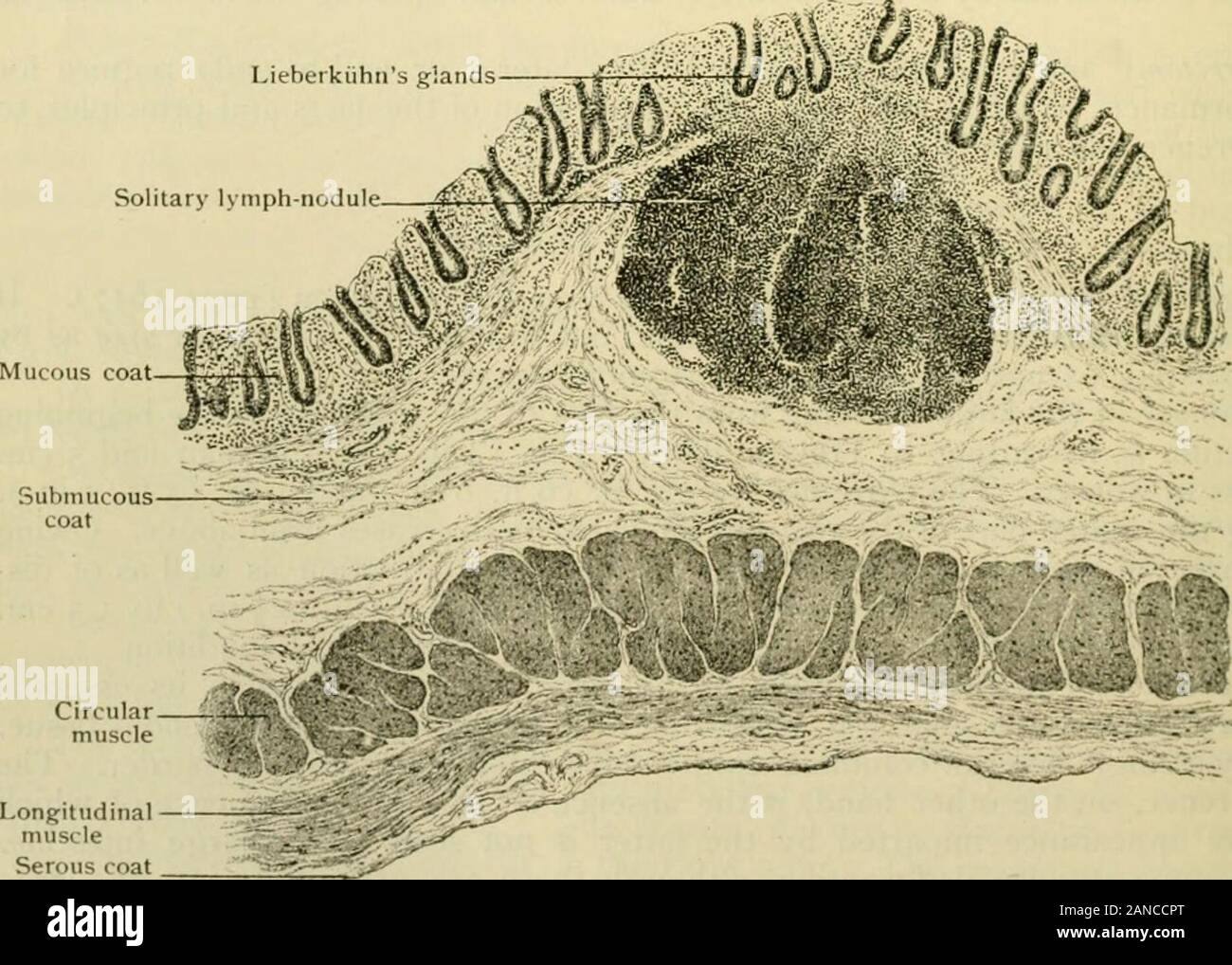 Anatomía Humana, entre ellas la estructura y el desarrollo y las consideraciones prácticas . H^ ??En* Como" 4^7 vistas de la superficie de la membrana mucosa de colon ascetidinji. Una, de tamaño natural ; B, magnificada 30 diámetros, mostrando el orificio de Lieberkiihns glándulas. suelen existir en tal profusión que las células normales son casi totalmente reemplazada ;hacia la parte más profunda, o fondo de ojo, de las glándulas son relativamente infrecuentes.La presencia de células caliciformes en dichas cuentas para los números considerables de moco amountof normalmente se vierte en el intestino grueso. Fig. 1407. Glándulas Lieberkiihns solitario nódulo linfático. Longit Foto de stock
